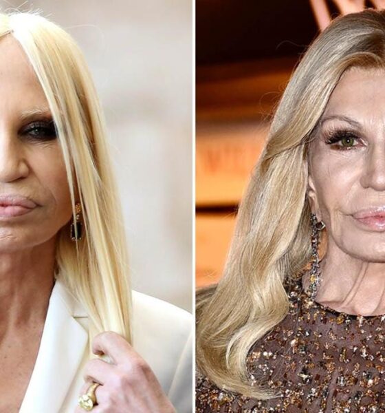 Donatella Versace Transformation Shines at Charity Gala